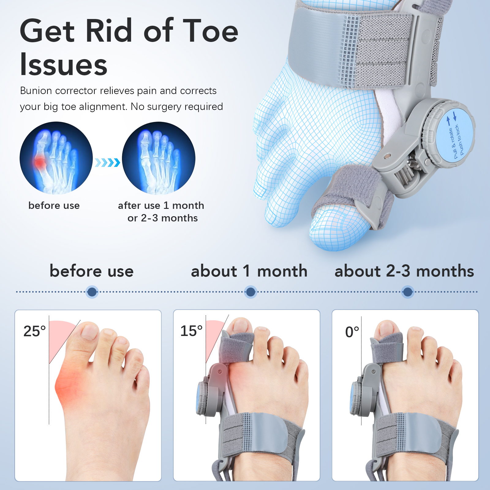 Big Toe Corrector Bunion Fix with Adjustable Knob Orthopedic Splint ...